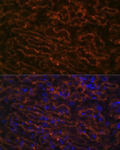 Anti-CYP26A1 Rabbit Monoclonal Antibody [clone: ARC2126]