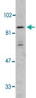 Anti-IKBKB Rabbit Polyclonal Antibody