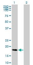 Anti-C9orf89 Mouse Polyclonal Antibody