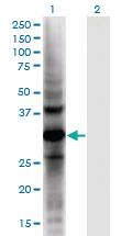 Anti-AKR1E2 Mouse Monoclonal Antibody [clone: 1C8]