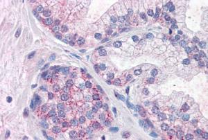 Anti-PDE11A Antibody (A83476) (10 µg/ml) staining of paraffin embedded Human Prostate. Steamed antigen retrieval with citrate buffer pH 6, AP-staining