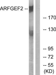 Western blot analysis of lysates from A549 cells using Anti-ARFGEF2 Antibody. The right hand lane represents a negative control, where the antibody is blocked by the immunising peptide