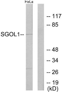 Western blot analysis of lysates from HeLa cells using Anti-SGOL1 Antibody. The right hand lane represents a negative control, where the Antibody is blocked by the immunising peptide