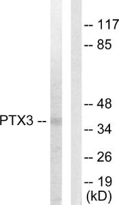 Antibody anti-PTX3 100 µg