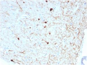 Immunohistochemical analysis of formalin-fixed, paraffin-embedded human cerebellum using Anti-Calretinin Antibody [CALB2/2786]