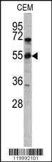 Anti-RUSC2 Rabbit Polyclonal Antibody