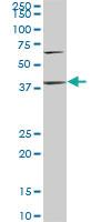 Anti-PTX3 Mouse Monoclonal Antibody [clone: 2B10]