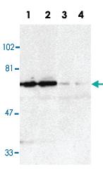 Anti-TNFRSF21 Rabbit Polyclonal Antibody