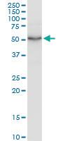 Anti-LSP1 Polyclonal Antibody Pair