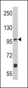 Anti-MUSK Rabbit Polyclonal Antibody (HRP (Horseradish Peroxidase))