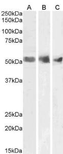 Anti-WT1 Antibody (A83477) (1 µg/ml) staining of Human Spleen (A), Kidney (B) and Testis (C) lysates (35 µg protein in RIPA buffer). Primary incubation was 1 hour. Detected by chemiluminescence