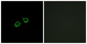 Immunofluorescence analysis of A549 cells using Anti-ARFGEF2 Antibody. The right hand panel represents a negative control, where the antibody was pre-incubated with the immunising peptide