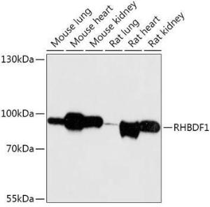 Anti-RHBDF1 Rabbit Polyclonal Antibody