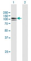 Anti-GAA Mouse Polyclonal Antibody