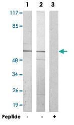 Anti-CYP2S1 Rabbit Polyclonal Antibody