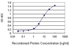 Anti-AKR1E2 Mouse Monoclonal Antibody [clone: 1C8]