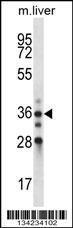 Anti-BLVRA Rabbit Polyclonal Antibody (HRP (Horseradish Peroxidase))