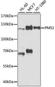 Anti-PMS1 Rabbit Polyclonal Antibody