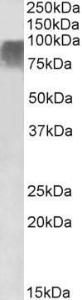 Anti-Prdm9 antibody