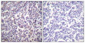 Immunohistochemical analysis of paraffin-embedded human lymph node tissue using Anti-B-RAF Antibody. The right hand panel represents a negative control, where the antibody was pre-incubated with the immunising peptide