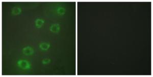 Antibody anti-PTX3 100 µg