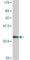 Anti-ALG1 Mouse Polyclonal Antibody