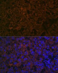 Anti-CYP26A1 Rabbit Monoclonal Antibody [clone: ARC2126]