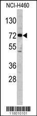 Anti-ELP2 Rabbit Polyclonal Antibody