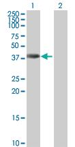 Anti-ANKRD1 Mouse Polyclonal Antibody