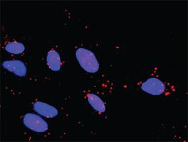 Anti-MAP2K3 + TAOK2 Antibody Pair