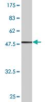 Anti-BDNF Mouse Monoclonal Antibody [clone: 1B10]