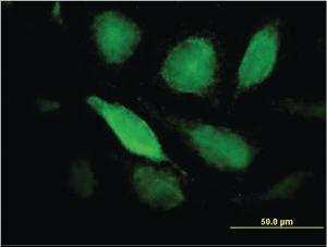 Anti-PTX3 Mouse Monoclonal Antibody [clone: 2B10]