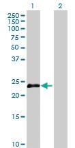 Anti-OIP5 Mouse Polyclonal Antibody