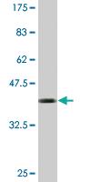 Anti-IFITM1 Mouse Monoclonal Antibody [clone: 1F8]