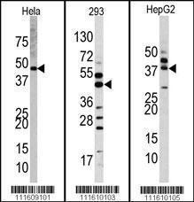 Anti-MAP Kinase 1 Rabbit Polyclonal Antibody (HRP (Horseradish Peroxidase))