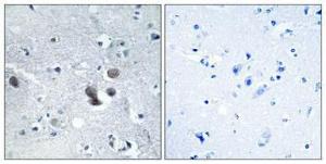 Immunohistochemical analysis of paraffin-embedded human brain using Anti-ARFGEF2 Antibody 1:100 (4°C overnight). The right hand panel represents a negative control, where the antibody was pre-incubated with the immunising peptide