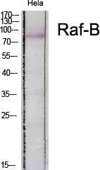 Western blot analysis of various cells using Anti-B-RAF Antibody