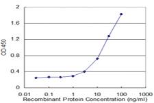 Anti-ALDH2 Mouse Monoclonal Antibody [clone: 4C11]