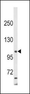 Anti-AP2A2 Rabbit Polyclonal Antibody