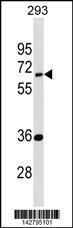 Anti-EDC3 Rabbit Polyclonal Antibody (PE (Phycoerythrin))