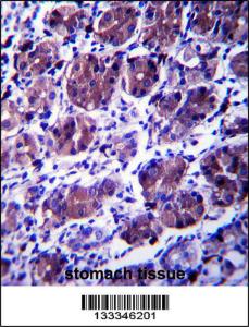 Anti-CCDC22 Rabbit Polyclonal Antibody (PE (Phycoerythrin))