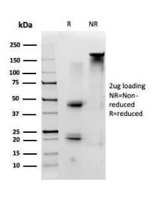 SDS-PAGE analysis of Anti-ID1 Antibody [PCRP-ID1-2F11] under non-reduced and reduced conditions; showing intact IgG and intact heavy and light chains, respectively. SDS-PAGE analysis confirms the integrity and purity of the antibody