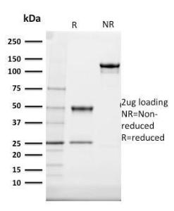 SDS-PAGE analysis of Anti-Cytokeratin 20 Antibody [SPM140] under non-reduced and reduced conditions; showing intact IgG and intact heavy and light chains, respectively. SDS-PAGE analysis confirms the integrity and purity of the antibody