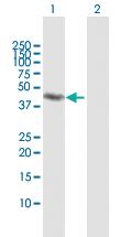 Anti-RNF113B Rabbit Polyclonal Antibody