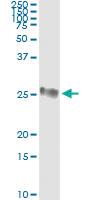 Anti-GSTP1 Antibody Pair