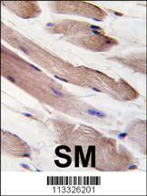 Anti-PIK3R1 Rabbit Polyclonal Antibody (FITC (Fluorescein Isothiocyanate))