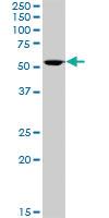 Anti-ALDH3A1 Mouse Polyclonal Antibody