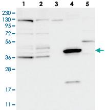 Anti-ZNF566 Rabbit Polyclonal Antibody