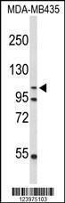 Anti-GEN1 Rabbit Polyclonal Antibody (PE (Phycoerythrin))