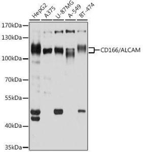 Western blot analysis of extracts of various cell lines, using Anti-CD166 Antibody (A9007) at 1:1,000 dilution The secondary antibody was Goat Anti-Rabbit IgG H&L Antibody (HRP) at 1:10,000 dilution Lysates/proteins were present at 25 µg per lane